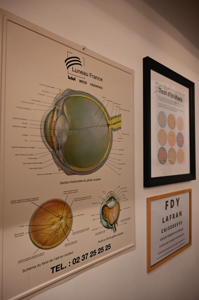 lunetier perigueux la francaise des yeux 5 768x1154
